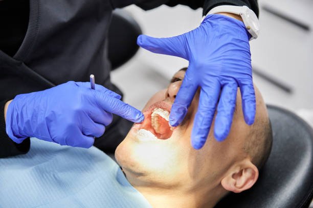 Tooth Infection Emergency Dentist in TX